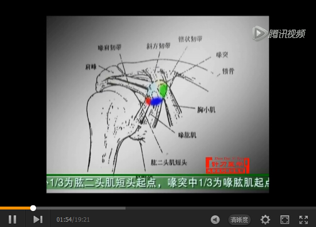 中国针刀医学光盘张天民