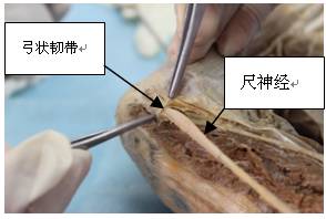 针刀治疗肘管综合症机理及临床操作