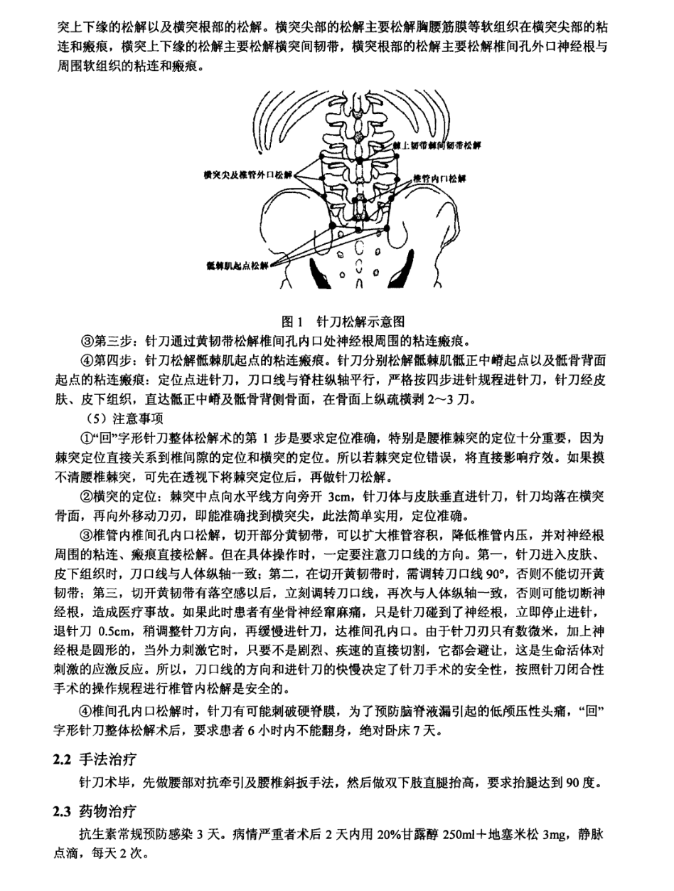 "回"字形针刀整体松解术治疗腰椎间盘突出症