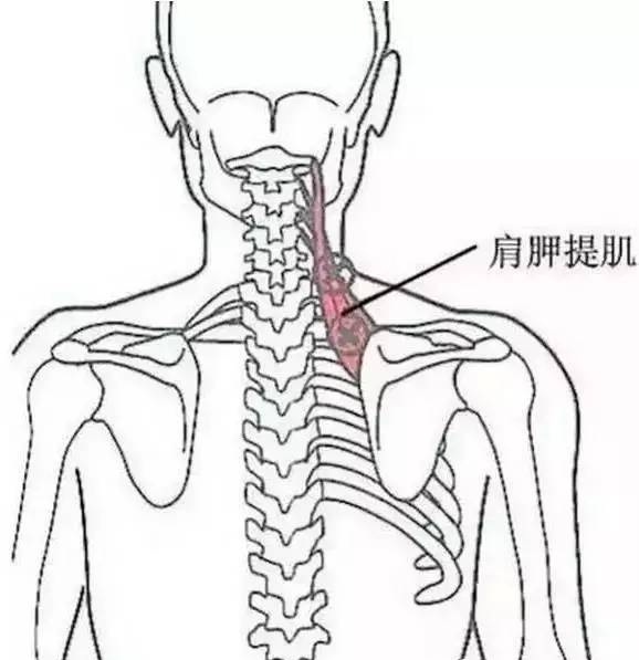 肩胛提肌压痛点