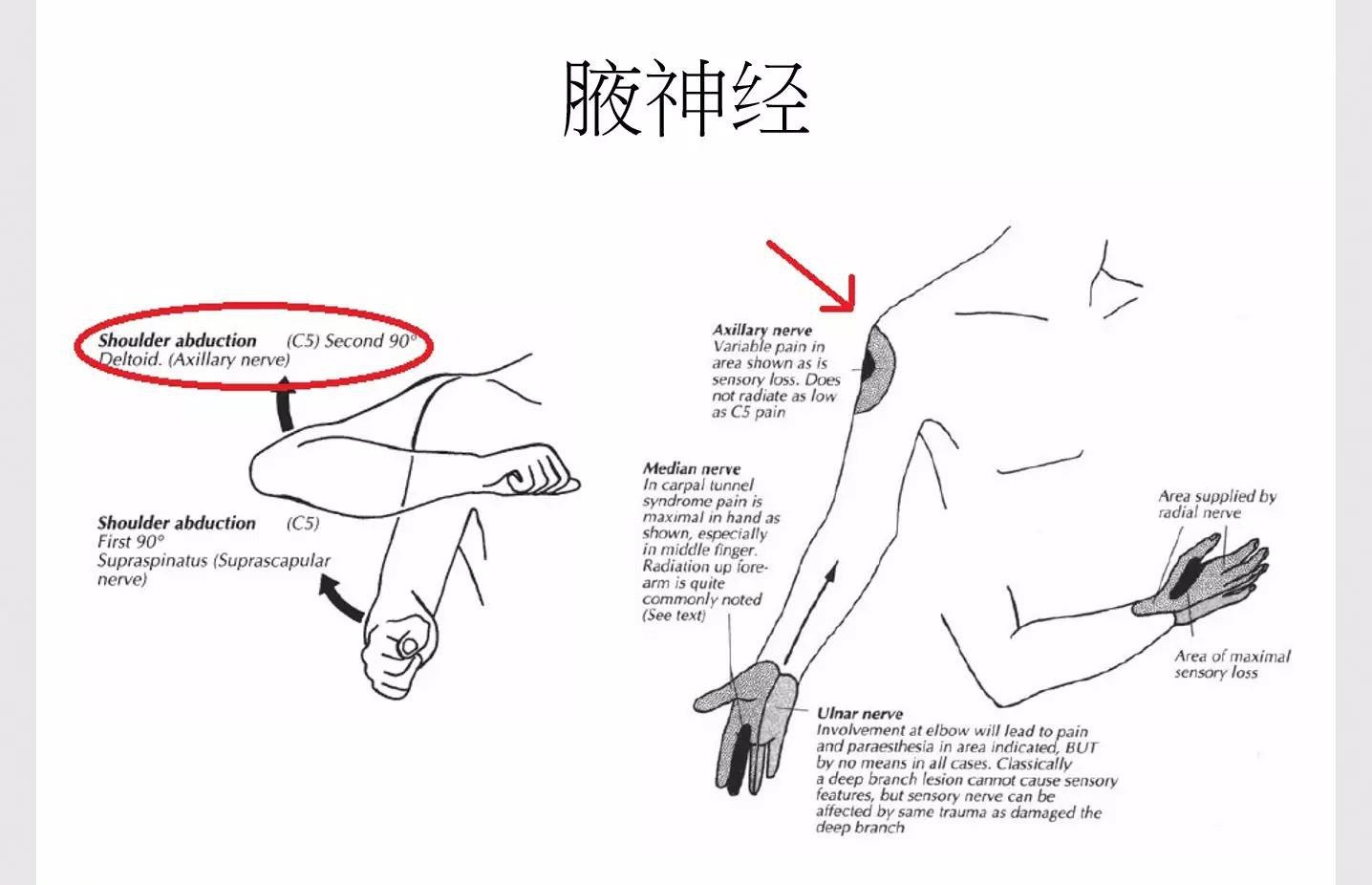 神经卡压综合征