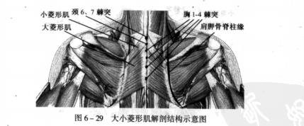 针刀治疗菱形肌损伤