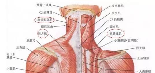 天民针刀肩胛提肌