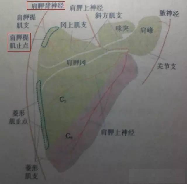 天民针刀肩胛提肌