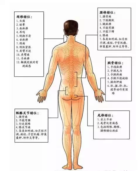 腰部和腰骶部压痛点怎么查