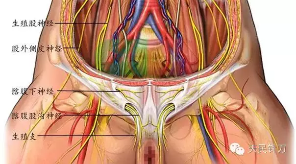 腰从神经天民针刀