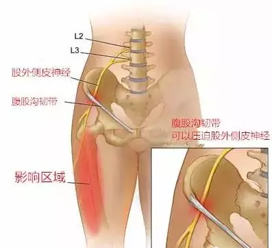 腰从神经天民针刀