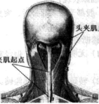 针刀治疗头夹肌损伤