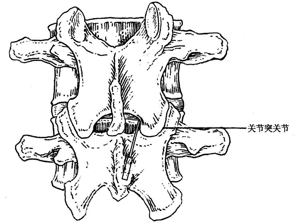 小针刀培训之腰椎横突的体表定位