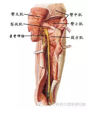 梨状肌综合征与腰椎间盘突出症鉴别