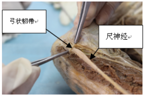 天民针刀肘关节