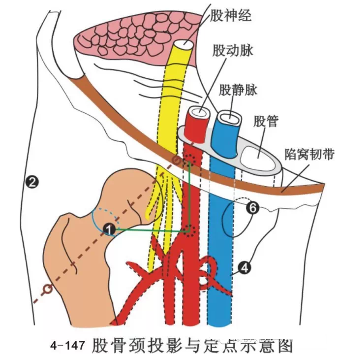 股骨头坏死针刀治疗精要