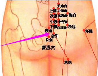 针刀治疗高危区带