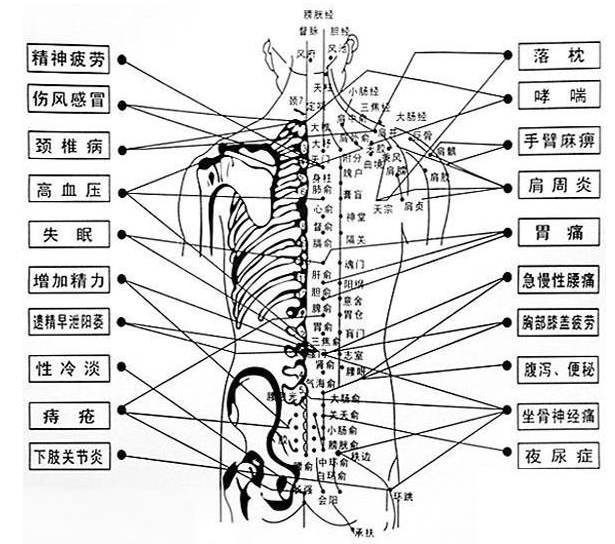 椎枕肌劳损的应用解剖及针刀治疗方案