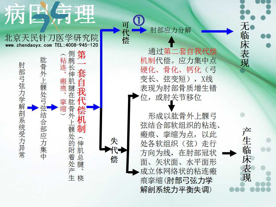 天民针刀专家王宗佼针刀治疗网球肘课件