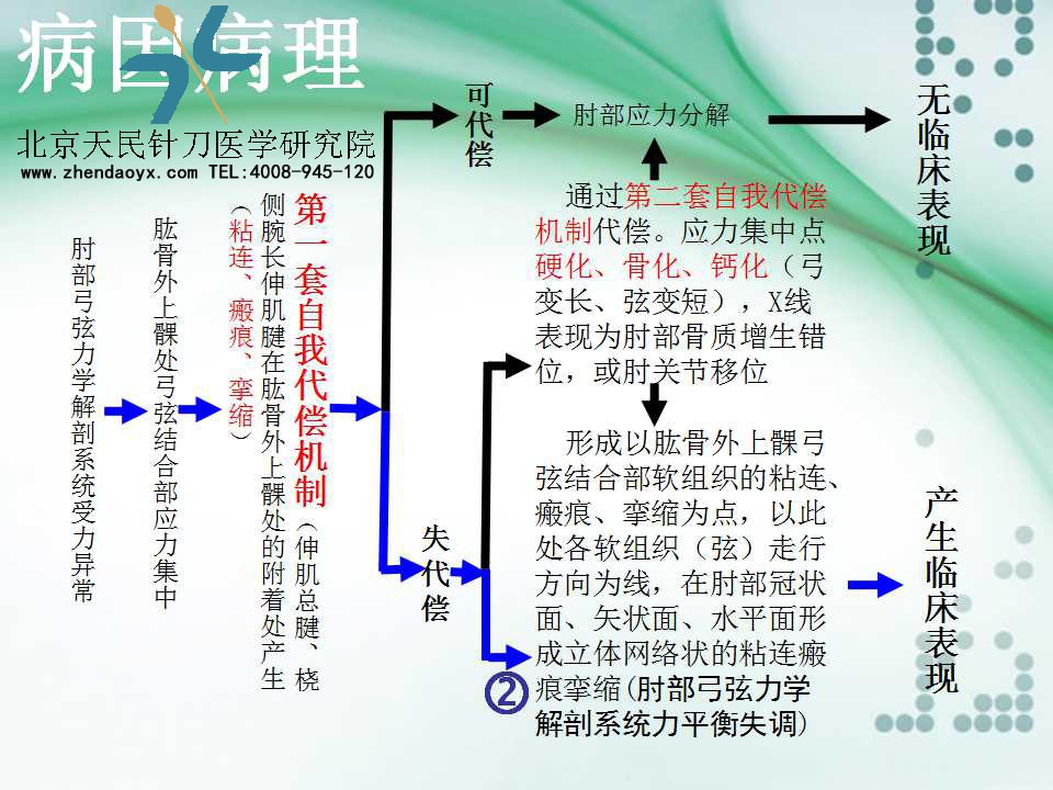 天民针刀专家王宗佼针刀治疗网球肘课件