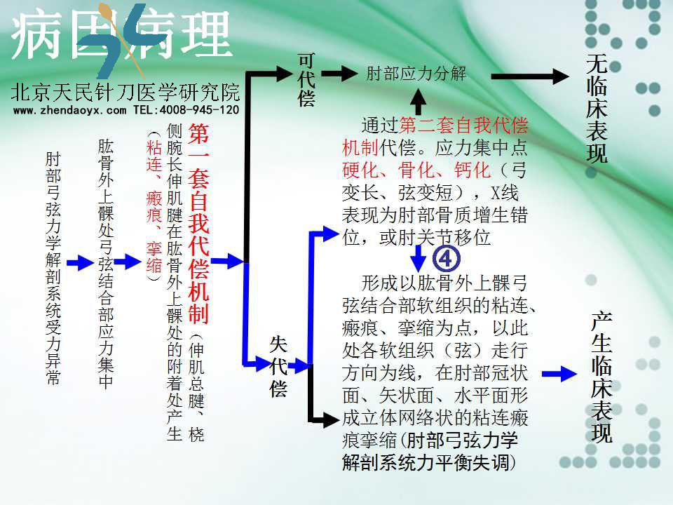 天民针刀专家王宗佼针刀治疗网球肘课件