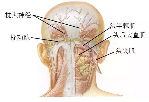 针刀治疗偏头痛