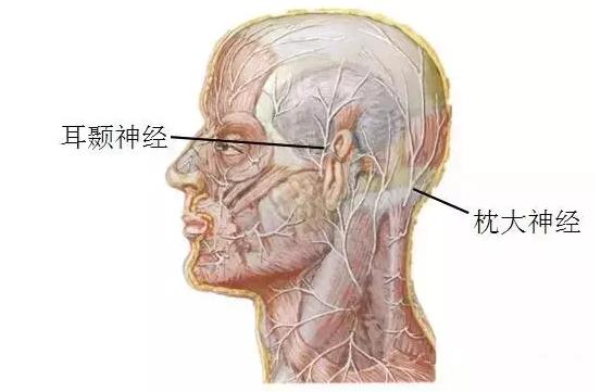 针刀治疗偏头痛