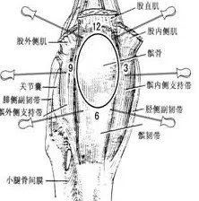 针刀治疗膝关节