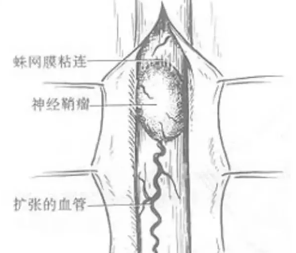 北京天民针刀医学研究院