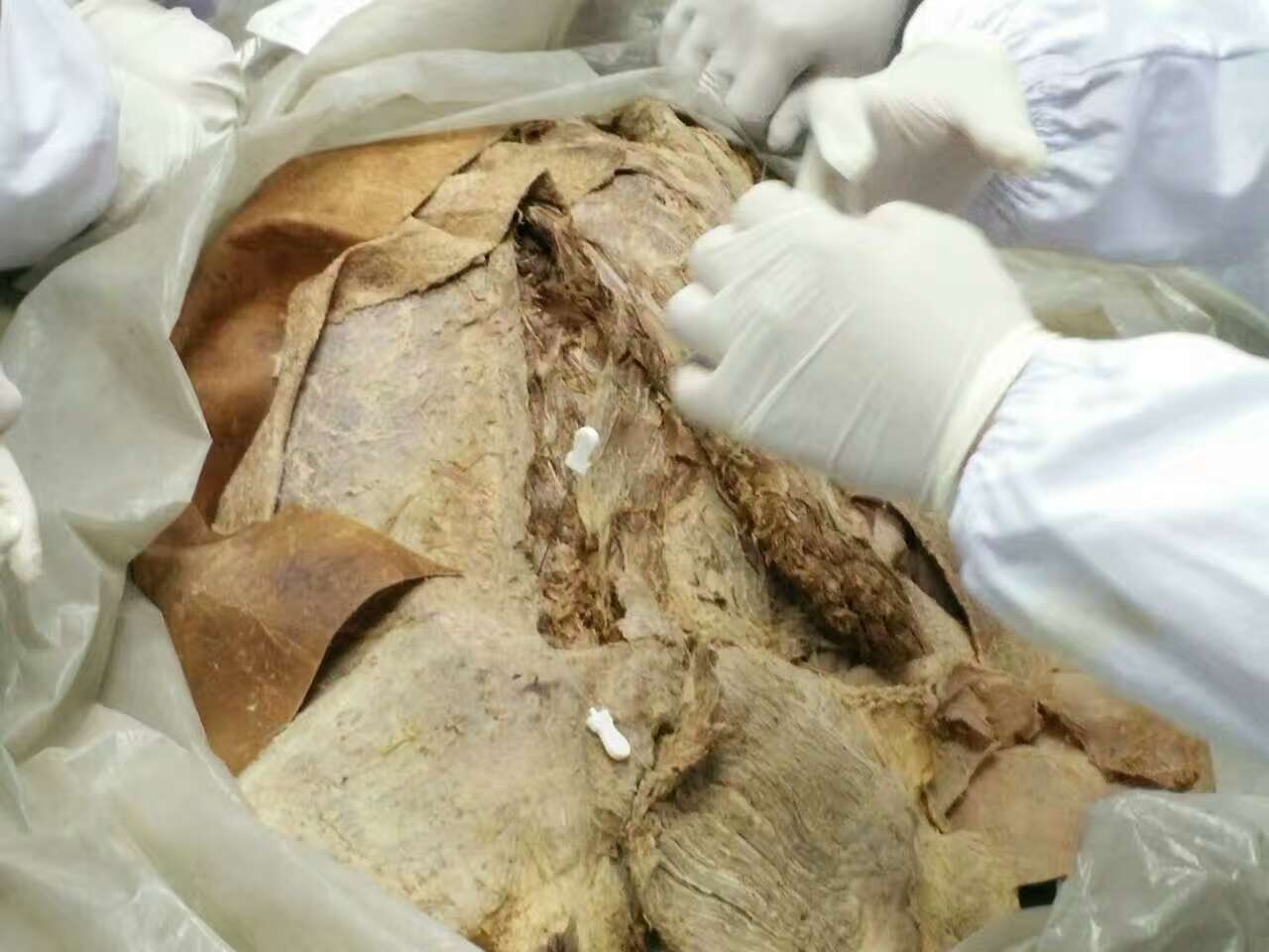 北京天民针刀医学研究院第二十届针刀整体松解术解剖班