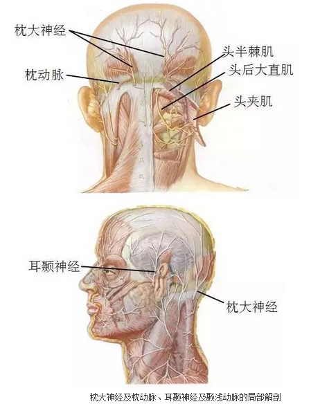 针刀治疗偏头疼