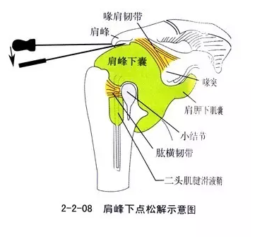 针刀治疗骨伤科颈肩腰腿痛疾病