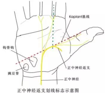 上肢疾病天民针刀诊疗