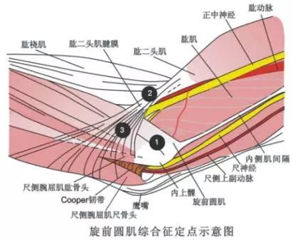 上肢疾病天民针刀诊疗